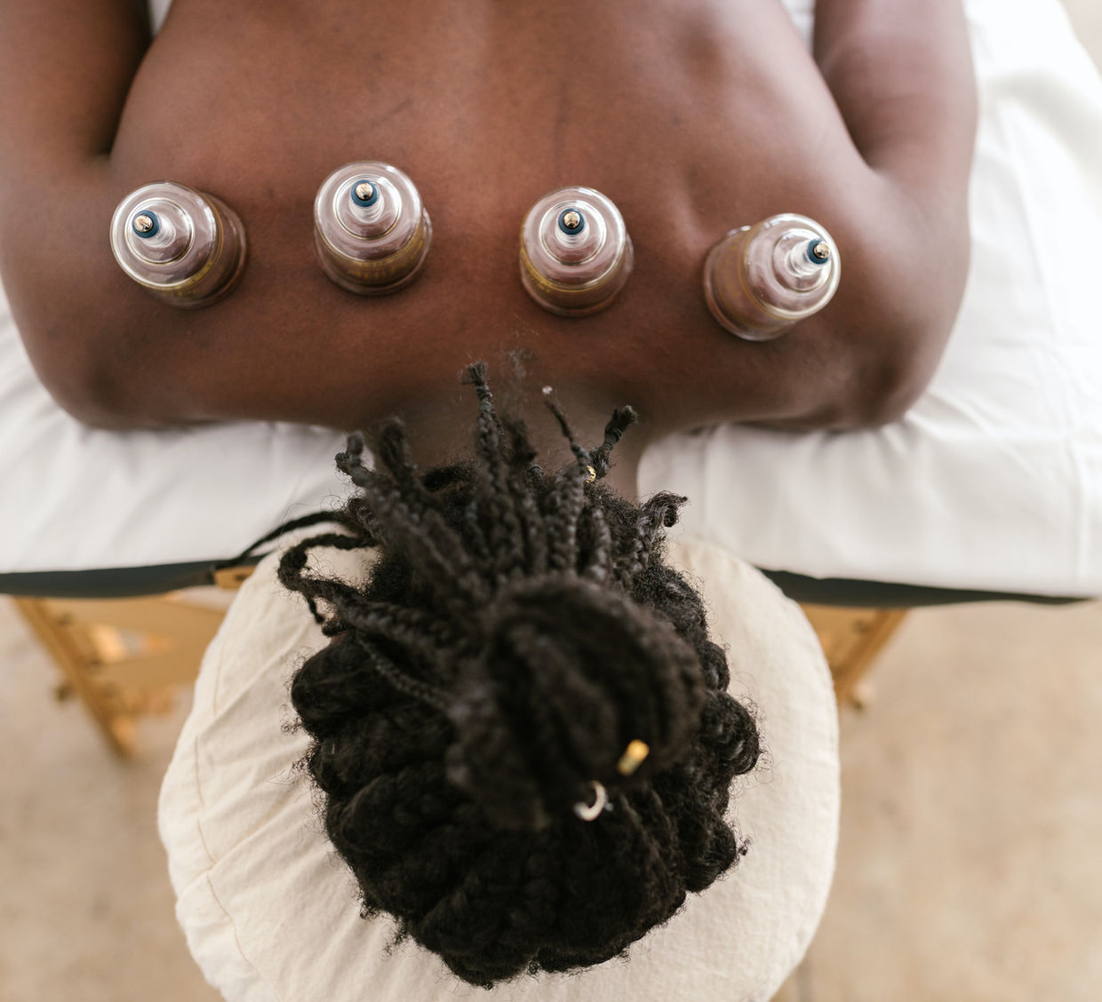 Cupping Therapy