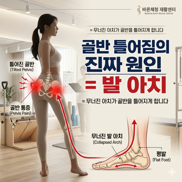 청주 골반 틀어짐 원인