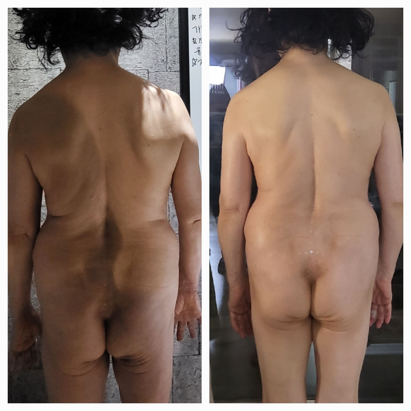 전신 정렬 변화 사례 6
