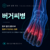 버거씨병
